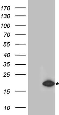 RMI2 / C16orf75 Antibody