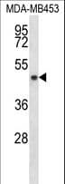 Polyclonal Rabbit anti-Human SIRT3 / Sirtuin 3 Antibody (aa56-84, WB)