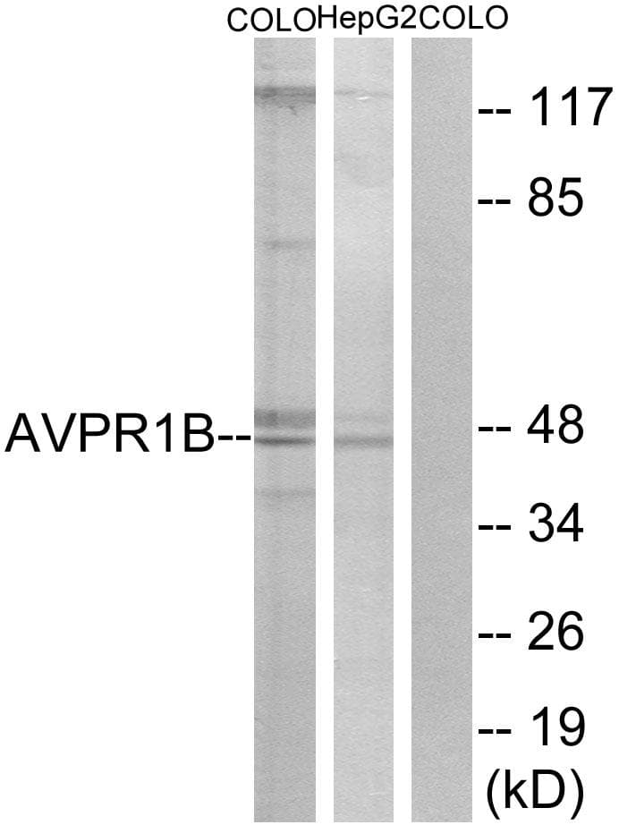 Polyclonal Rabbit anti-Human AVPR1B Antibody (WB)