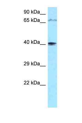 PIP5KL1 Antibody (aa254-303)
