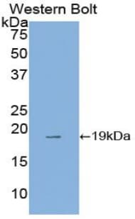 ANXA4 / Annexin IV Antibody (aa163-258, PE)