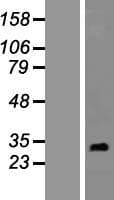 RNF151 Protein (Over-Expression Lysate Myc-DDK (Flag))