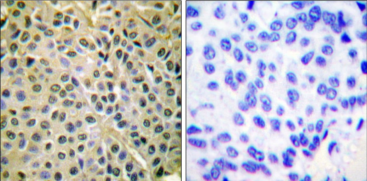 AKT1 + AKT2 + AKT3 Antibody (phospho-Ser473)