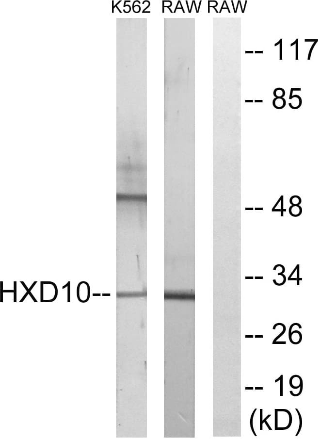 HOXD10 Antibody (aa291-340)