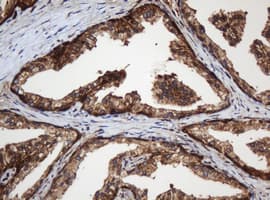 PAI-RBP1 / SERBP1 Antibody (aa1-262, clone OTI2C11)