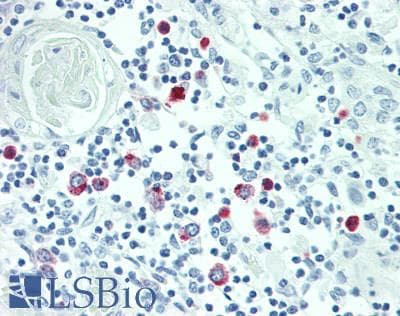 IHC-plus™ Polyclonal Rabbit anti-Human SRGN / Serglycin Antibody (IHC)