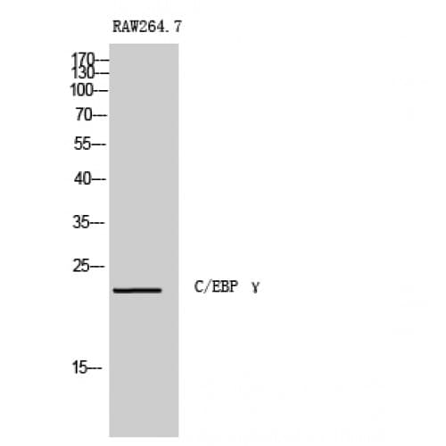 Polyclonal Rabbit anti-Human CEBPG / CEBP Gamma Antibody (1-80 aa, Internal, IHC, IF, WB)