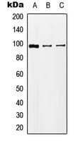 Polyclonal Rabbit anti-Human GRIK5 / KA2 Antibody (C-Terminus, WB)
