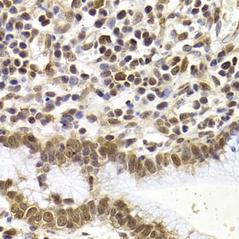 SMAD1 Antibody