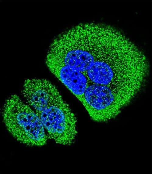 SOWAHD / ANKRD58 Antibody (aa196-224)