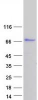 Human CAST / Calpastatin Protein (Recombinant Myc-DDK (Flag))