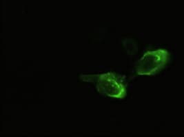 NEUROG3 / NGN3 / Neurogenin 3 Antibody (clone OTI3B5)