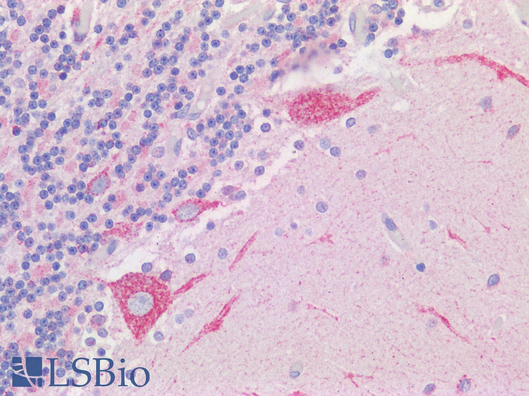 IHC-plus™ Polyclonal Rabbit anti-Human VDAC2 Antibody (N-Terminus, IHC)