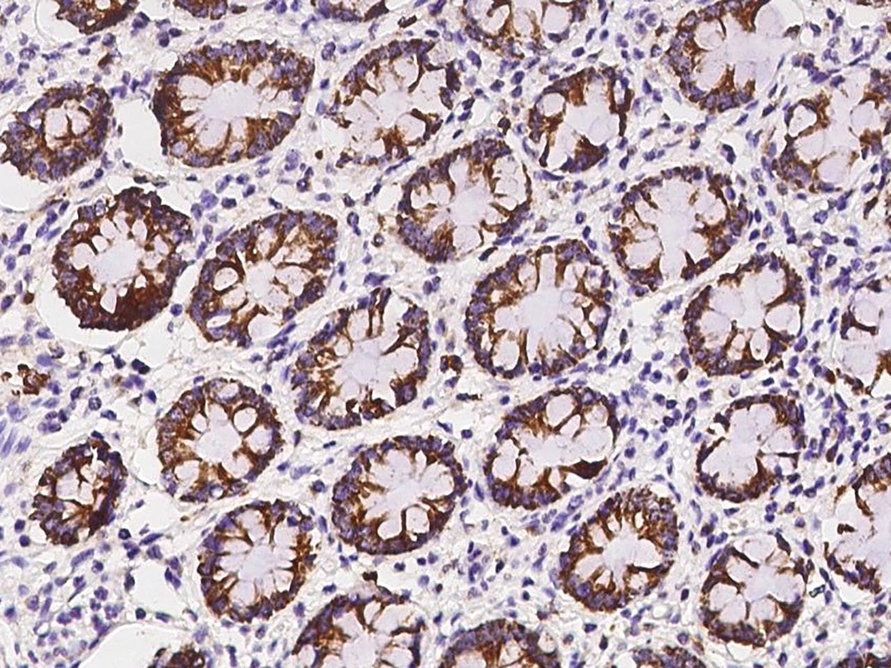 AMT Antibody