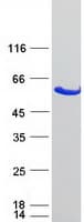 Human GBA3 / CBG Protein (Recombinant Myc-DDK (Flag))