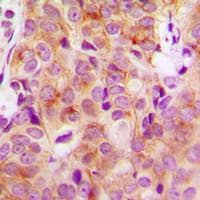 HRS / HGS Antibody (Internal)