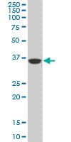 PBK / TOPK Antibody (clone 3A11)