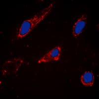 CYP2C19 Antibody (Internal)