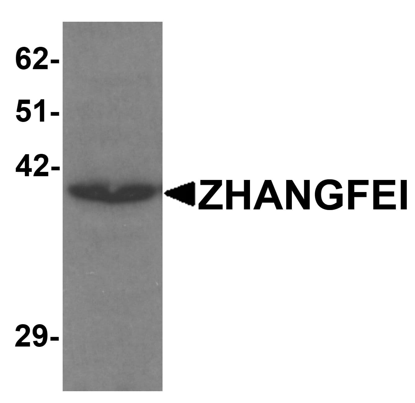 CREBZF / Zhangfei Antibody