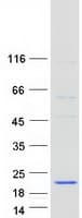 Human NDUFB6 Protein (Recombinant Myc-DDK (Flag))