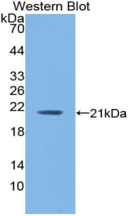 HBA1+2 / Hemoglobin Alpha Antibody (aa1-142)