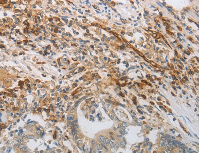 PECAM-1 / CD31 Antibody