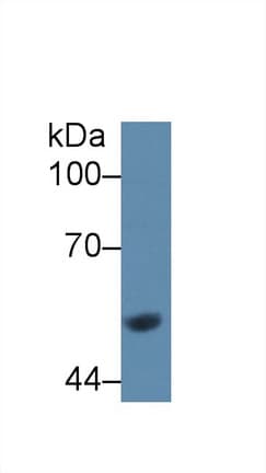 GCK / Glucokinase Antibody