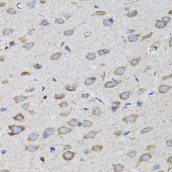 PSMD10 / Gankyrin Antibody