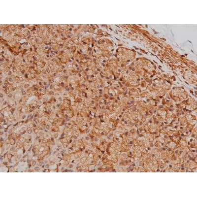 MAPT / Tau Antibody (phospho-Ser262)