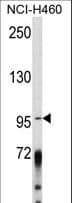 Polyclonal Rabbit anti-Human AKAP110 / AKAP3 Antibody (aa240-267, WB)