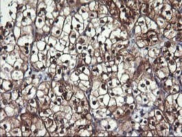 Monoclonal Mouse anti-Human BBOX1 / BBOX Antibody (clone OTI8B12, IHC, WB)