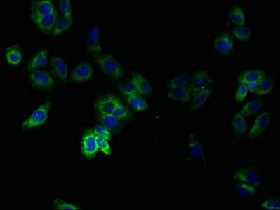 Polyclonal Rabbit anti-Human TMEM14B Antibody (aa1-114, WB)