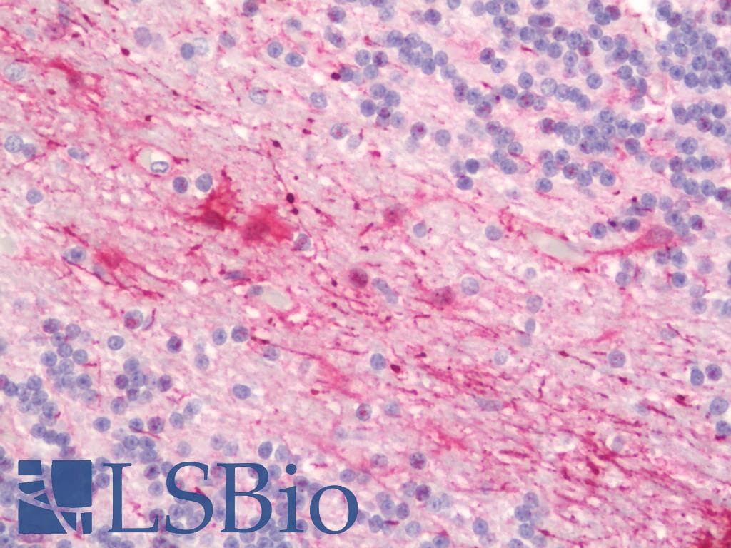 IHC-plus™ CYBB / NOX2 / gp91phox Antibody (aa471-510)