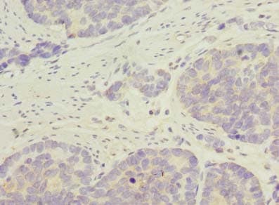 C9orf89 Antibody