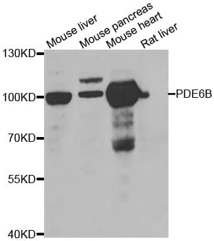 PDE6B / PDE6 Beta Antibody