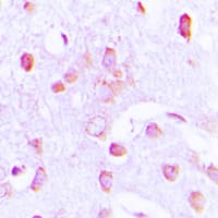 EIF2AK3 / PERK Antibody (N-Terminus)