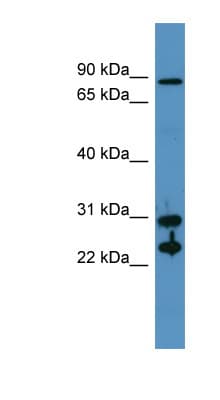 CA2 / Carbonic Anhydrase II Antibody (aa73-122)