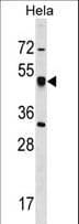 CRTAP Antibody (aa31-59)