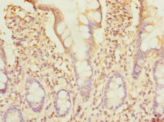 STX7 / Syntaxin 7 Antibody