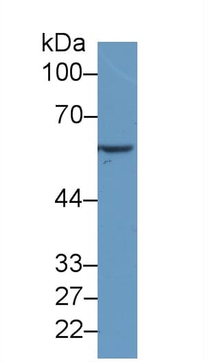 TNFSF14 / LIGHT Antibody (aa62-240)