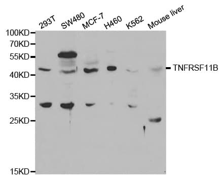 OPG / Osteoprotegerin Antibody