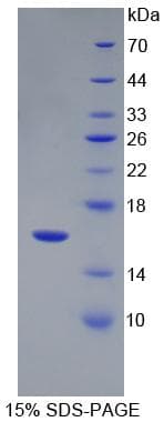 Rat NRG1 / Heregulin / Neuregulin Protein (Recombinant His)