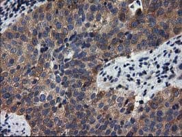 ADSL / Adenylosuccinate Lyase Antibody (clone OTI2D10)