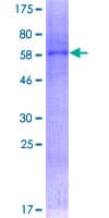 Human SIRT6 / Sirtuin 6 Protein (Recombinant GST)