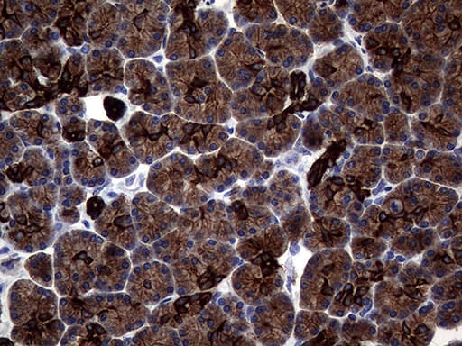 KRT18 / CK18 / Cytokeratin 18 Antibody (aa69-372, clone OTI10G8)