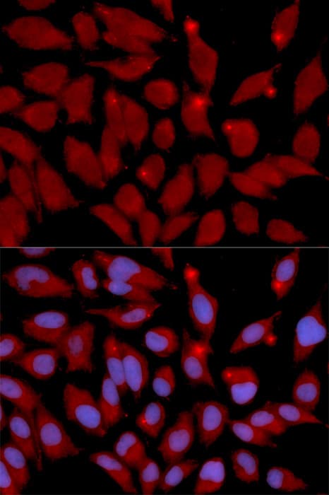 DNMT3A Antibody