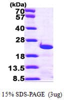 Human CETN3 Protein (Recombinant His)