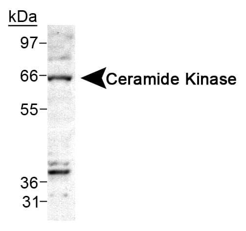 Ceramide Kinase / CERK Antibody (Internal, Biotin)