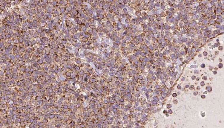 Polyclonal Rabbit anti-Human SPRING / TRIM9 Antibody (IHC, IF, WB)