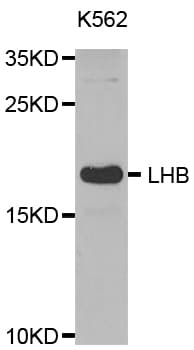 Polyclonal Rabbit anti-Human LHB / Luteinizing Hormone Antibody (IHC, WB)